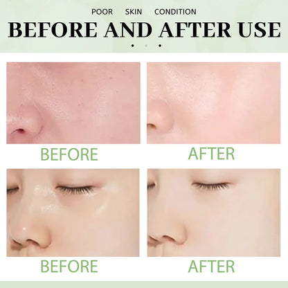Green Tea Cleansing Stick Mask – Pore & Acne Care